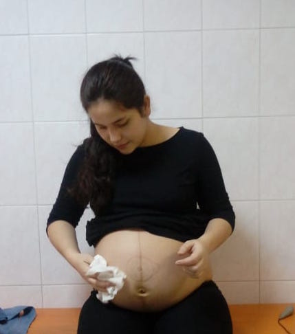Ведение беременности в клинике ЛИЦ