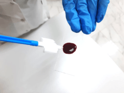 Половые инфекции передающиеся через кровь